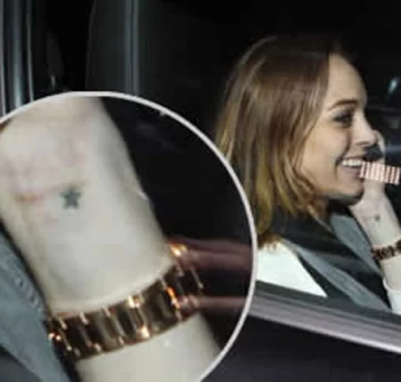 Luce una extraña cicatriz Luce una extraña cicatriz