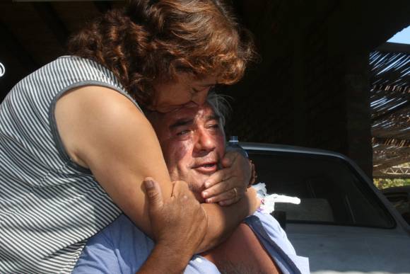 Se perdió casi dos días en el campo y sobrevivió por su orina Se perdió casi dos días en el campo y sobrevivió por su orina