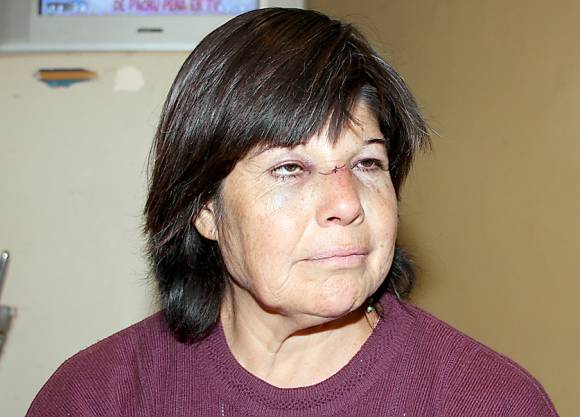 Madre de 11 hijos y estudiante quebrada de una piña en un robo Madre de 11 hijos y estudiante quebrada de una piña en un robo