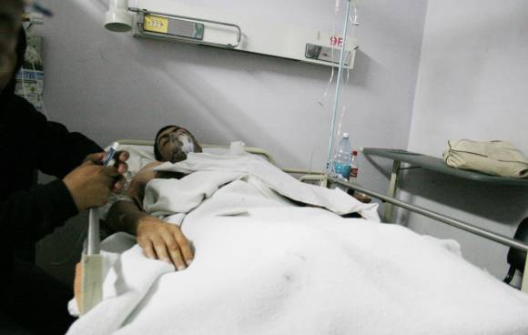 El drama de un albañil que cayó de su moto y perdió una pierna El drama de un albañil que cayó de su moto y perdió una pierna