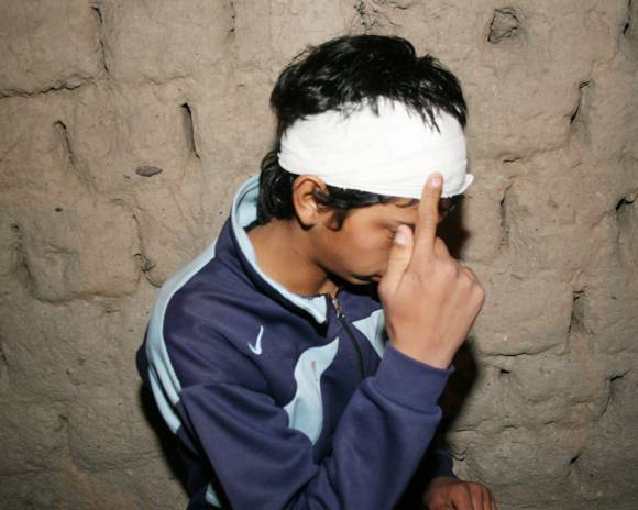 Le dieron un tiro en la cabeza en un confuso hecho Le dieron un tiro en la cabeza en un confuso hecho