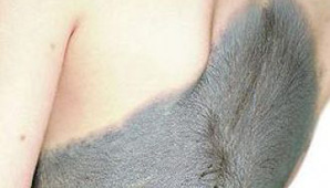 “Nena-gato” sorprende a la comunidad médica “Nena-gato” sorprende a la comunidad médica