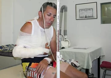 Toledo, fracturado Toledo, fracturado