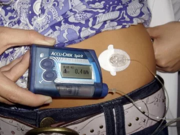 Diabetes infantil: un problema que crece y esperanzas que llegan Diabetes infantil: un problema que crece y esperanzas que llegan
