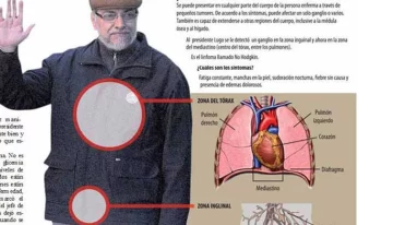 Paraguay: Lugo está más grave y habló su posible sucesor Paraguay: Lugo está más grave y habló su posible sucesor