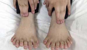 El niño de 31 dedos El niño de 31 dedos