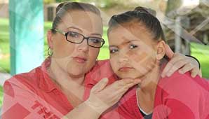 Le inyecta botox a su nena Le inyecta botox a su nena