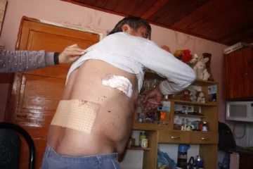 Acuchillado Acuchillado