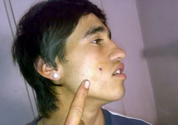 Un tiro de alto riesgo por resistir un asalto Un tiro de alto riesgo por resistir un asalto