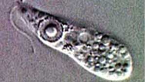 Ameba “comecerebros” Ameba “comecerebros”