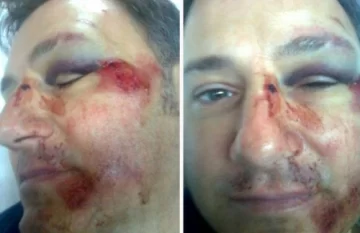 Golpiza a un director, un detenido y paro docente Golpiza a un director, un detenido y paro docente