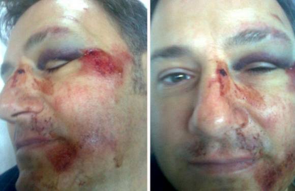 Golpiza a un director, un detenido y paro docente Golpiza a un director, un detenido y paro docente