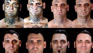 Se quitó los tatuajes Se quitó los tatuajes