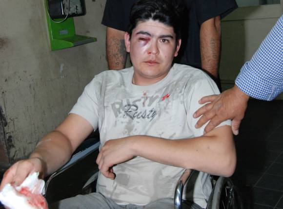 Un baleado y otros 4 heridos en violento cruce de hinchas Un baleado y otros 4 heridos en violento cruce de hinchas