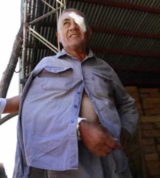 Quebraron a golpes a un hombre para poder robar Quebraron a golpes a un hombre para poder robar