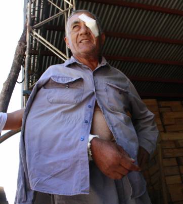 Quebraron a golpes a un hombre para poder robar Quebraron a golpes a un hombre para poder robar