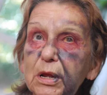 Un nuevo asalto a Centeno Un nuevo asalto a Centeno