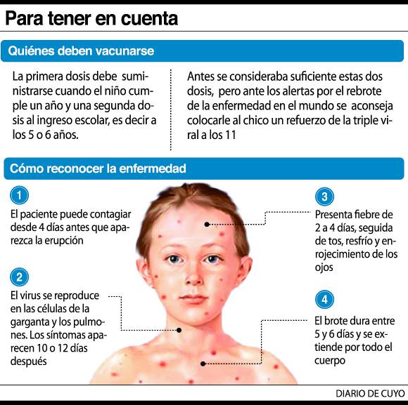 Alerta por brote de sarampión Alerta por brote de sarampión