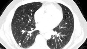 ¿Ves el Gorila? ¿Ves el Gorila?