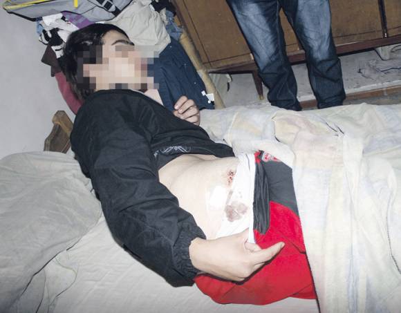 Le dan 4 puntazos a un chico en un asalto Le dan 4 puntazos a un chico en un asalto