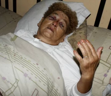 Intentó frustrar un robo y lo balearon Intentó frustrar un robo y lo balearon