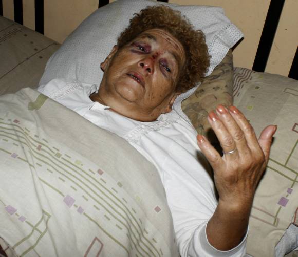 Intentó frustrar un robo y lo balearon Intentó frustrar un robo y lo balearon