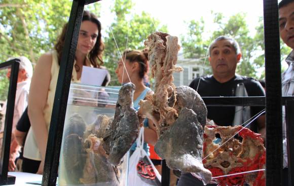 Tabaquismo: concientizan apelando al impacto visual Tabaquismo: concientizan apelando al impacto visual