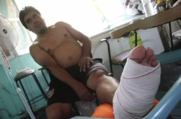 Por una pelea de su hijo, le dieron un balazo en un pie Por una pelea de su hijo, le dieron un balazo en un pie