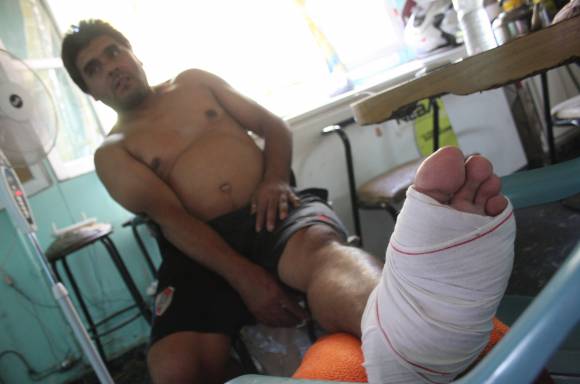 Por una pelea de su hijo, le dieron un balazo en un pie Por una pelea de su hijo, le dieron un balazo en un pie