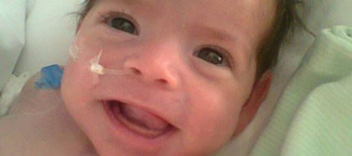 Con sólo 5 meses se sobrepuso a una operación del corazón, pero ahora necesita ayuda Con sólo 5 meses se sobrepuso a una operación del corazón, pero ahora necesita ayuda