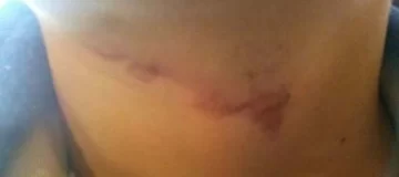 Tras la denuncia de la familia, un médico legista determinará las lesiones del menor “ahorcado” Tras la denuncia de la familia, un médico legista determinará las lesiones del menor “ahorcado”