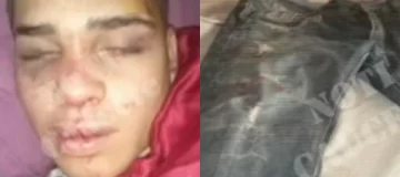 Golpiza a joven caucetero: un detenido, buscan a otros 2 y no descartan un ajuste de cuentas Golpiza a joven caucetero: un detenido, buscan a otros 2 y no descartan un ajuste de cuentas