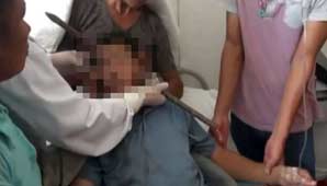 Una barra de metal le atravesó la cabeza… ¡y sobrevivió! Una barra de metal le atravesó la cabeza… ¡y sobrevivió!