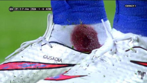 Brutal patada Brutal patada