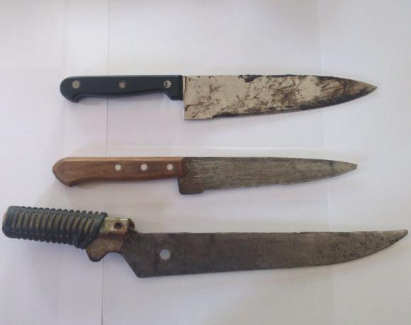 Robó, acosó y lesionó a la víctima Robó, acosó y lesionó a la víctima