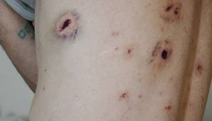 Policías debían custodiar un cumpleaños de 15 y terminaron baleando a los invitados Policías debían custodiar un cumpleaños de 15 y terminaron baleando a los invitados