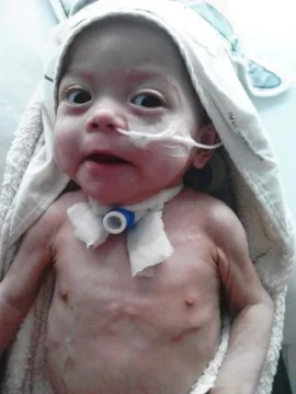 Tiene 13 meses, desde que nació está internada y necesita ayuda Tiene 13 meses, desde que nació está internada y necesita ayuda