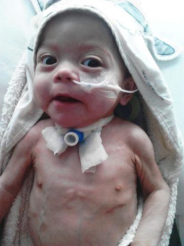 Tiene 13 meses, desde que nació está internada y necesita ayuda Tiene 13 meses, desde que nació está internada y necesita ayuda