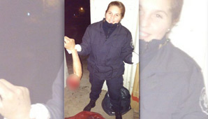 Se sacó una foto con el brazo de un hombre accidentado Se sacó una foto con el brazo de un hombre accidentado