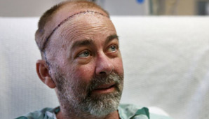 Trasplante inédito Trasplante inédito