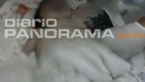 Nació un bebé con dos cabezas Nació un bebé con dos cabezas