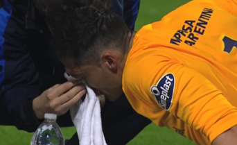 En pleno partido, Caranta sufrió fractura expuesta de tabique En pleno partido, Caranta sufrió fractura expuesta de tabique