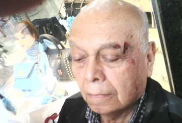 Herido por marco de vidriera Herido por marco de vidriera