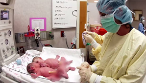 Conexión de gemelos Conexión de gemelos