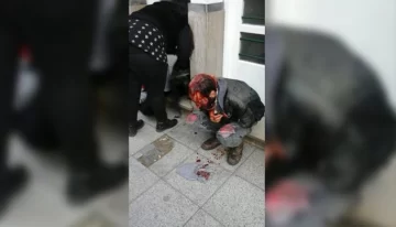 Un grupo neonazi atacó con caños a una pareja gay Un grupo neonazi atacó con caños a una pareja gay