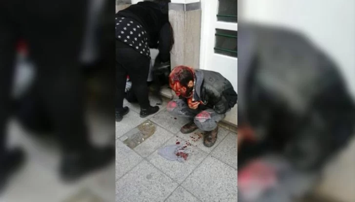 Un grupo neonazi atacó con caños a una pareja gay Un grupo neonazi atacó con caños a una pareja gay