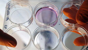 Temor por una nueva enfermedad de transmisión sexual Temor por una nueva enfermedad de transmisión sexual