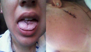 Apuñaló a su ex y sólo estuvo preso un par de horas Apuñaló a su ex y sólo estuvo preso un par de horas