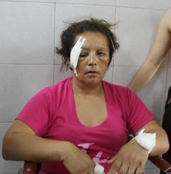 A martillazos, casi mató a su exmujer cuando dormía A martillazos, casi mató a su exmujer cuando dormía