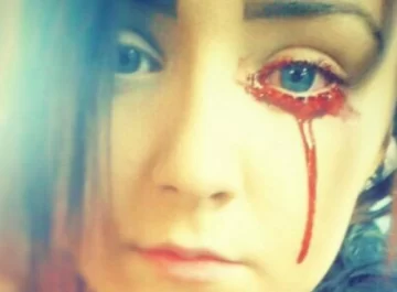 Sangra por los ojos y nadie sabe por qué Sangra por los ojos y nadie sabe por qué